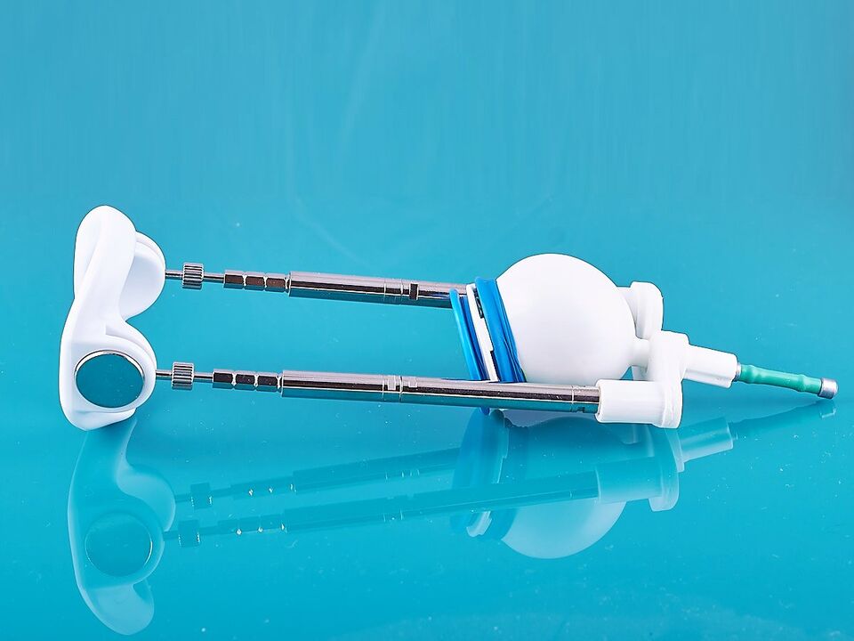 The extender will help improve the ligamentotomy outcome