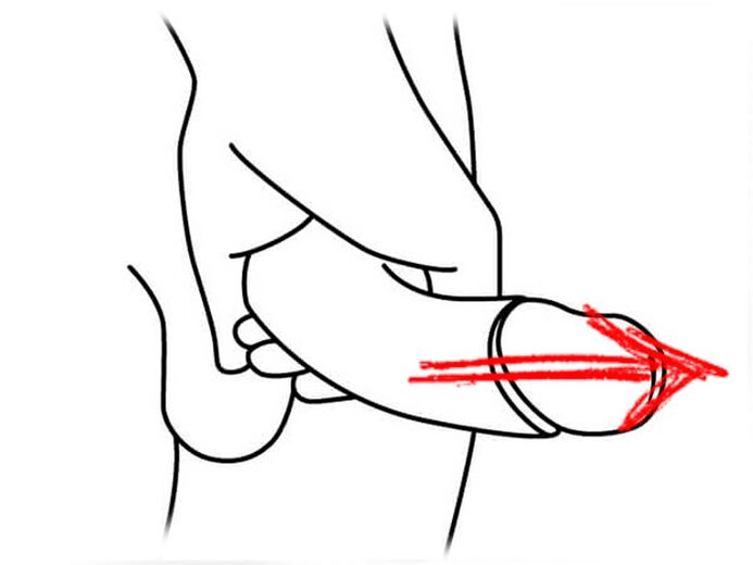 lengthening the penis to enlarge